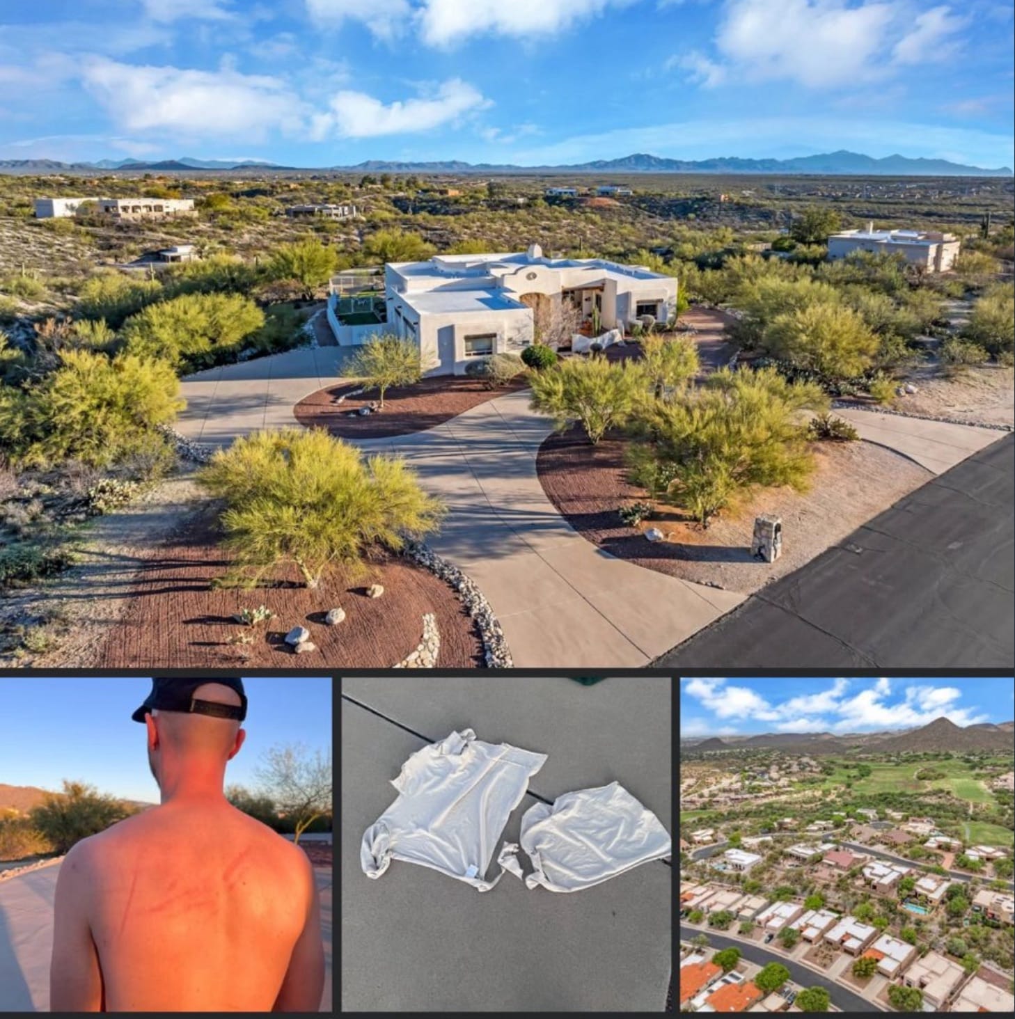 Aerial of a Tucson desert home with insets of the pilot's injuries and torn shirt.